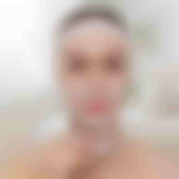 Gezichtsverstevigende liftband | KIMLIFT